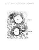 Small Peptides And Methods For Treatment Of Chronic Obstructive Pulmonary     Disease diagram and image