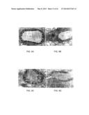 Small Peptides And Methods For Treatment Of Chronic Obstructive Pulmonary     Disease diagram and image