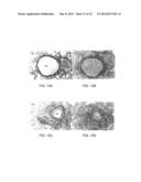 Small Peptides And Methods For Treatment Of Chronic Obstructive Pulmonary     Disease diagram and image