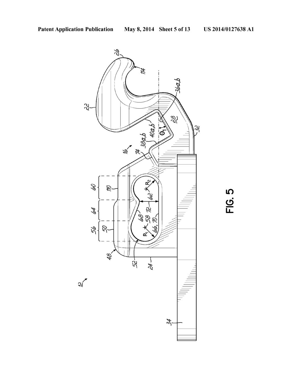 ORTHODONTIC BRACKET HAVING A BIASED SLIDE MEMBER - diagram, schematic, and image 06