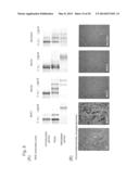 METHOD FOR DIAGNOSING TYPE OF PANCREATIC TUMOR diagram and image