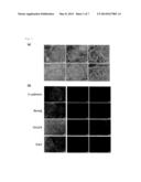 iPS CELL HAVING DIFFERENTIATION PROPENSITY FOR CORNEAL EPITHELIUM diagram and image