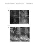 iPS CELL HAVING DIFFERENTIATION PROPENSITY FOR CORNEAL EPITHELIUM diagram and image