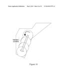 Robotic Surface Treatment  Device diagram and image