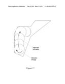 Robotic Surface Treatment  Device diagram and image