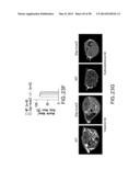 UNDERCARBOXYLATED/UNCARBOXYLATED OSTEOCALCIN INCREASES BETA-CELL     PROLIFERATION, INSULIN SECRETION, INSULIN SENSITIVITY, GLUCOSE TOLERANCE     AND DECREASES FAT MASS diagram and image