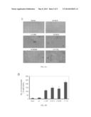 ANAPLASTIC THYROID CANCERS HARBOR NOVEL ONCOGENIC MUTATIONS OF THE ALK     GENE diagram and image