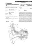 MRI Safe Actuator for Implantable Floating Mass Transducer diagram and image