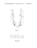 PELVIC IMPLANT WITH SUSPENDING SYSTEM diagram and image