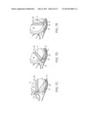 PELVIC IMPLANT WITH SUSPENDING SYSTEM diagram and image