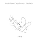 PELVIC IMPLANT WITH SUSPENDING SYSTEM diagram and image