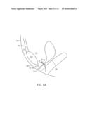 PELVIC IMPLANT WITH SUSPENDING SYSTEM diagram and image