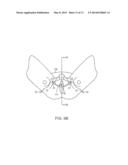 PELVIC IMPLANT WITH SUSPENDING SYSTEM diagram and image