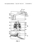 GENTLE HEMORRHOID TREATMENT OFFERING A SUBSTANTIALLY PAINLESS HEALING diagram and image