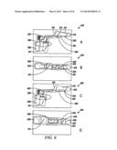 GENTLE HEMORRHOID TREATMENT OFFERING A SUBSTANTIALLY PAINLESS HEALING diagram and image