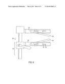 Sternal Retractor diagram and image