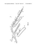 Sternal Retractor diagram and image