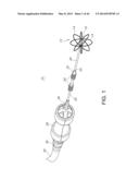 METHODS FOR DETECTION OF CARDIAC RHYTHM DISORDERS USING BASKET STYLE     CARDIAC MAPPING CATHETER diagram and image