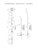 METHODS FOR DETECTION OF CARDIAC RHYTHM DISORDERS USING BASKET STYLE     CARDIAC MAPPING CATHETER diagram and image