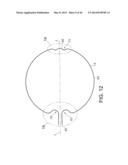 METHODS FOR DETECTION OF CARDIAC RHYTHM DISORDERS USING BASKET STYLE     CARDIAC MAPPING CATHETER diagram and image