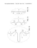 METHODS FOR DETECTION OF CARDIAC RHYTHM DISORDERS USING BASKET STYLE     CARDIAC MAPPING CATHETER diagram and image