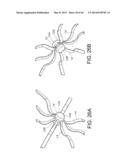 METHODS FOR DETECTION OF CARDIAC RHYTHM DISORDERS USING BASKET STYLE     CARDIAC MAPPING CATHETER diagram and image