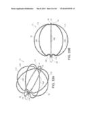 METHODS FOR DETECTION OF CARDIAC RHYTHM DISORDERS USING BASKET STYLE     CARDIAC MAPPING CATHETER diagram and image