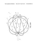 METHODS FOR DETECTION OF CARDIAC RHYTHM DISORDERS USING BASKET STYLE     CARDIAC MAPPING CATHETER diagram and image