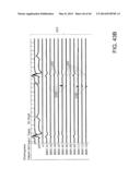 METHODS FOR DETECTION OF CARDIAC RHYTHM DISORDERS USING BASKET STYLE     CARDIAC MAPPING CATHETER diagram and image