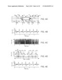 Noise tolerant localization systems and methods diagram and image