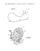 SYSTEMS AND METHODS FOR HEMODYNAMIC DETECTION OF CIRCULATORY ANOMALIES diagram and image