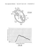 SYSTEMS AND METHODS FOR HEMODYNAMIC DETECTION OF CIRCULATORY ANOMALIES diagram and image