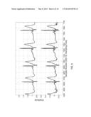 ELECTROCARDIOGRAM SIGNAL DETECTION diagram and image