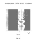 SEIZURE DETECTION AND EPILEPTOGENIC LESION LOCALIZATION diagram and image