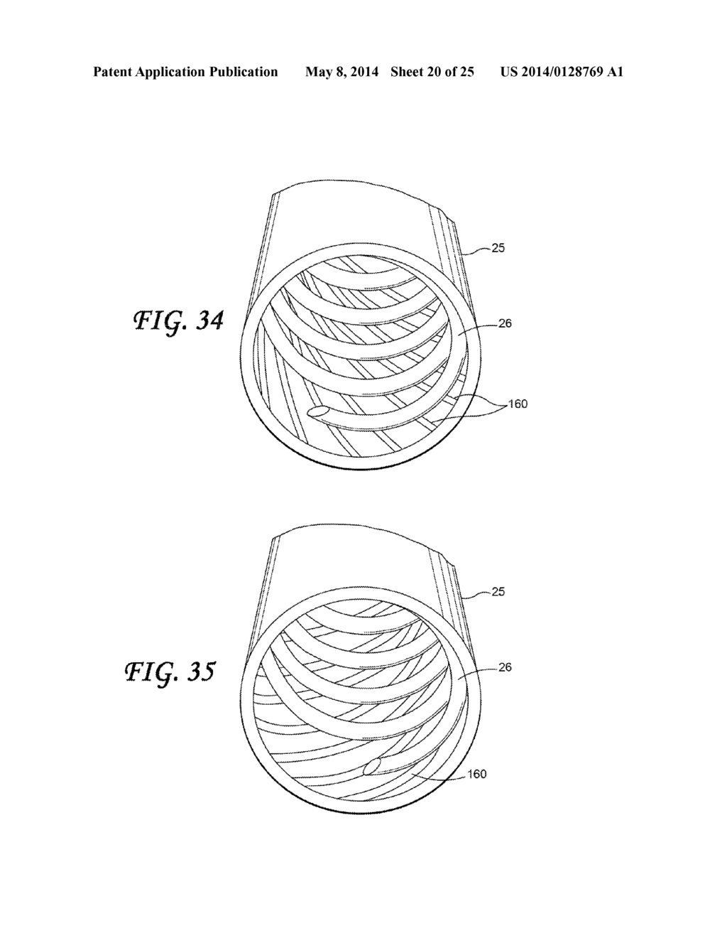 SOFT TISSUE CORING BIOPSY DEVICES AND METHODS - diagram, schematic, and image 21