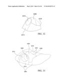 VASCULAR BLOOD SAMPLING CATHETER diagram and image