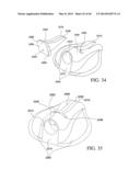 VASCULAR BLOOD SAMPLING CATHETER diagram and image