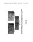 FLEX CIRCUIT/BALLOON ASSEMBLIES UTILIZING TEXTURED SURFACES FOR ENHANCED     BONDING diagram and image