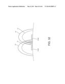 FLEX CIRCUIT/BALLOON ASSEMBLIES UTILIZING TEXTURED SURFACES FOR ENHANCED     BONDING diagram and image