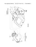 IMAGE-GUIDED THERAPY OF A TISSUE diagram and image