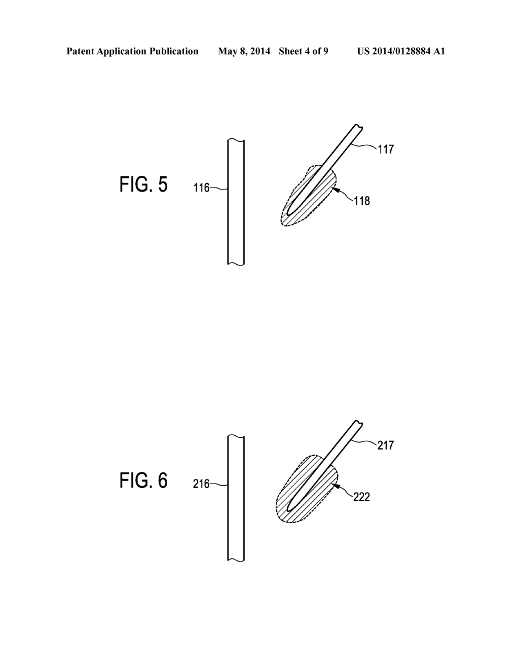 ABLATED OBJECT REGION DETERMINING APPARATUSES AND METHODS - diagram, schematic, and image 05