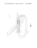 SELF LOCKING KNOTLESS SUTURE diagram and image