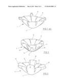 Surgical Implant diagram and image