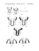 DEVICE TO NARROW THE COLUMELLA AND TO DILATE THE NASAL VALVE diagram and image