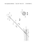 SNAP-ON VASCULAR CLOSURE DEVICE AND METHODS diagram and image