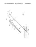 SNAP-ON VASCULAR CLOSURE DEVICE AND METHODS diagram and image