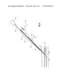 SNAP-ON VASCULAR CLOSURE DEVICE AND METHODS diagram and image