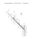 SNAP-ON VASCULAR CLOSURE DEVICE AND METHODS diagram and image