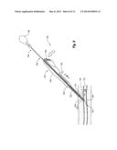 SNAP-ON VASCULAR CLOSURE DEVICE AND METHODS diagram and image