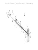 SNAP-ON VASCULAR CLOSURE DEVICE AND METHODS diagram and image